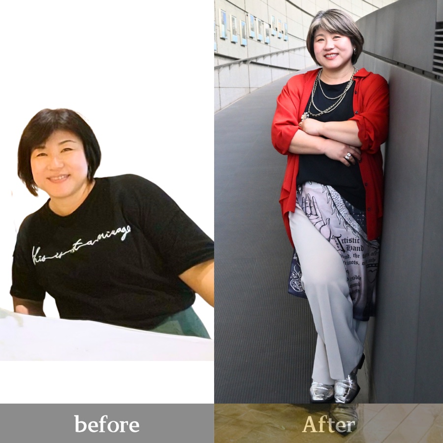 Nさん Before / After